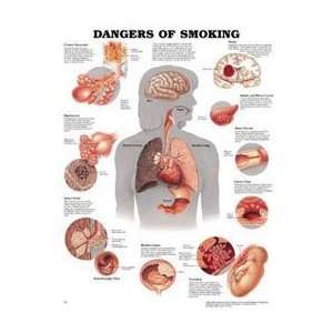   Smoking 20x26 Ea by, Anatomical Chart Company:  Industrial