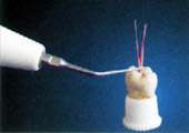   root canal cleaning sterilizing and taking out the stem in root canal