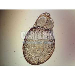 Mammal Spinal Ganglion and Nerve, l.s. Microscope Slide, 7 u:  