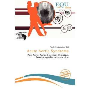  Acute Aortic Syndrome (9786200586506) Wade Anastasia Jere Books