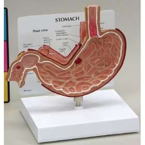 Stomach Anatomical Model Gastric Ulcer Esophageal  